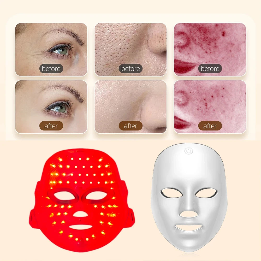Rechargeable LED Photon Facial Mask – At-Home Light Therapy for Glowing Skin