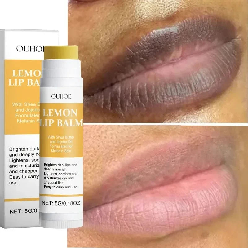 Turmeric Dark Lip Lightening Balm