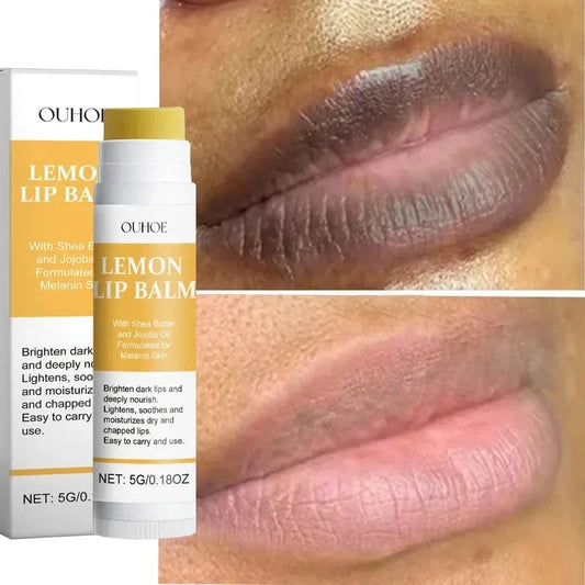 Turmeric Dark Lip Lightening Balm